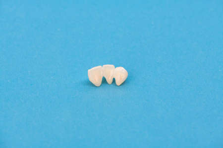 Metal free ceramic teeth implant dental crowns isolated on a blue background.の写真素材