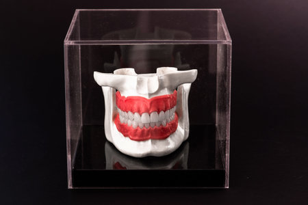 Human jaw with teeth implants anatomy model isolated on black background in a glass box.