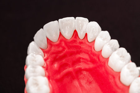 Teeth implant and crown installation process parts isolated on a blue background. Medically accurate...