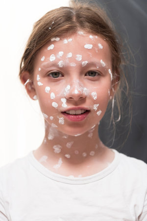 Portrait of a little school girl with chickenpox, antiseptic cream applied to face and body .Colorful background.の写真素材