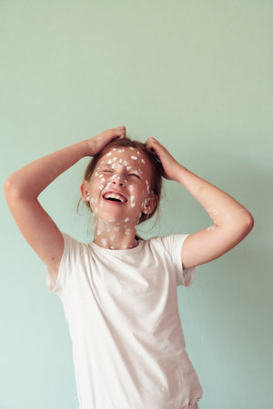 Portrait of a little school girl with chickenpox, antiseptic cream applied to face and body .Colorful background.の写真素材