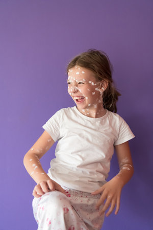 Portrait of a little school girl with chickenpox, antiseptic cream applied to face and body .Colorful background.の写真素材