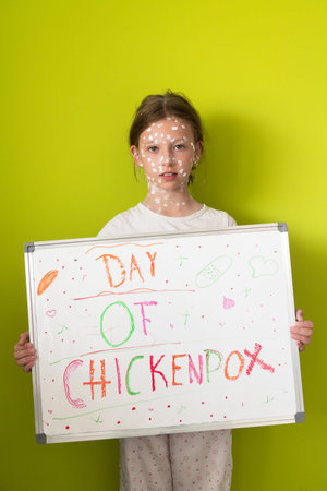 A little schoolgirl with chickenpox draws a message on the whiteboard in the kids room, and antiseptic cream is applied to the face and body. Chalkboard background.の写真素材