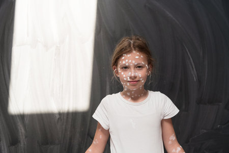 Portrait of a little school girl with chickenpox, antiseptic cream applied to face and body .Chalkboard background.の写真素材