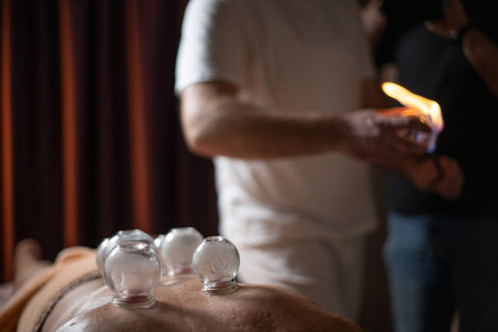 Close up of a traditional fire cupping therapy session with glass cups placed on a patients back and...