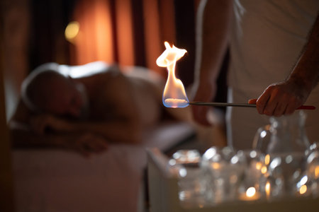 Close up of a traditional fire cupping therapy session with glass cups placed on a patients back and therapist using fire to create suction, promoting relaxation and healing.の写真素材