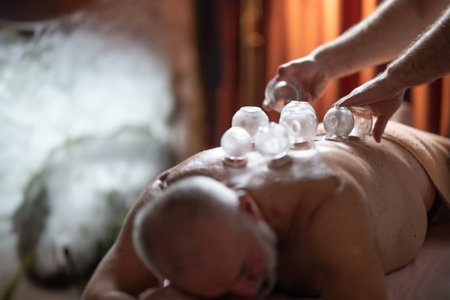 Close up of a traditional fire cupping therapy session with glass cups placed on a patients back and therapist using fire to create suction, promoting relaxation and healing.の写真素材