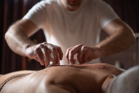 Close up of therapist applying cupping therapy on male clients back during wellness and rehabilitation treatment, traditional alternative medicine for relaxation and pain relief.の写真素材