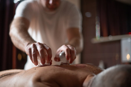Close up of therapist applying cupping therapy on male clients back during wellness and rehabilitation treatment, traditional alternative medicine for relaxation and pain relief.の写真素材