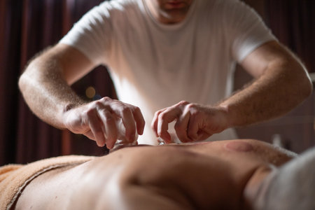 Close up of therapist applying cupping therapy on male clients back during wellness and rehabilitation treatment, traditional alternative medicine for relaxation and pain relief.の写真素材