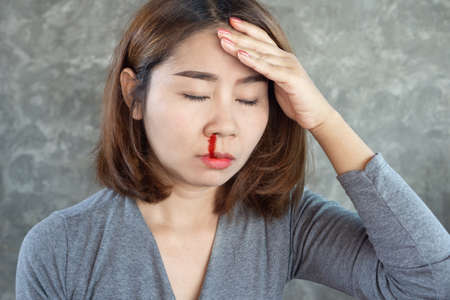 Asian woman have nosebleed, bloody nose hand holding head feeling unwellの写真素材