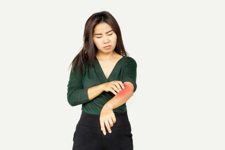 Asian woman having skin problem and scratching her itchy arm cause of dry skin, food and drugs allergies ,dermatitis  conceptの写真素材
