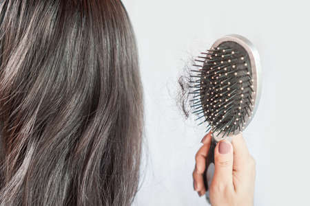 Asian woman having problem with hair loss hand holding comb with hair fallの写真素材