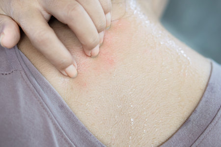 closeup woman hand scratching her sweat skin itchy because of allergy