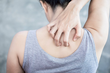 closeup woman hand scratching her skin itchy because of allergy to hot weatherの写真素材