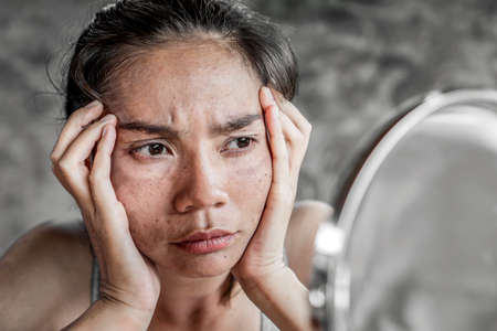 sad Asian woman having skin problem checking her face with dark spot, freckle from uv light in mirrorの写真素材