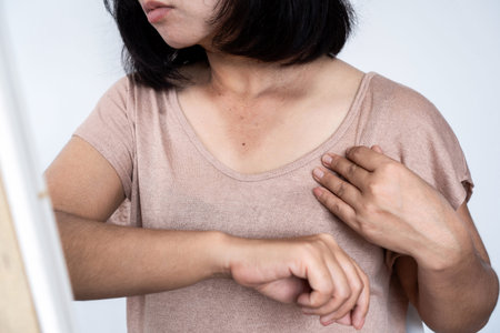 Asian woman with sunburned on neck and arm, skin damage and darker with wrinkles caused by uv light...