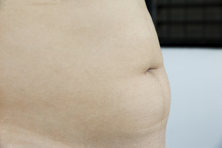 fat female body part - she will have to loose some weightの写真素材