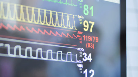 Medical monitor displaying patient vital signs, showing heart rate and blood pressure