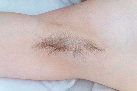 Closeup of long dark hair growing under arm of young female. Concept of hygiene, Female hairy...