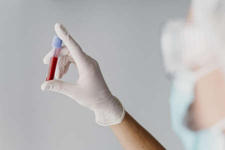 back view doctor holding blood sample. High quality beautiful photo conceptの写真素材