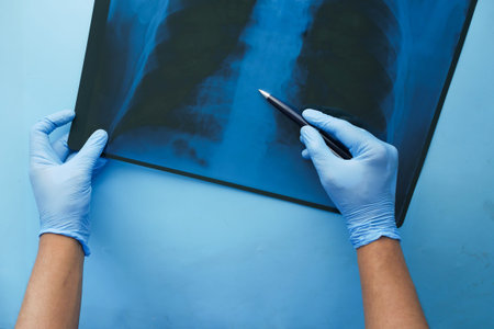 doctor hold analyzing xray photography closeup