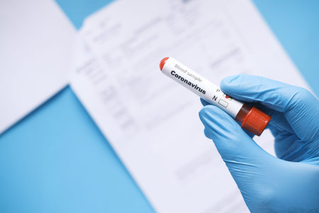 hand in blue medical gloves holding blood test tube ,