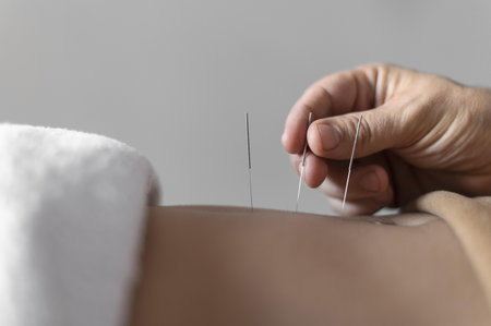 close up hand holding acupuncture needle. Resolution and high quality beautiful photoの写真素材