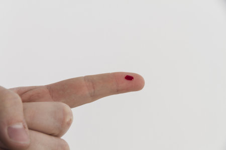 bleeding finger. Resolution and high quality beautiful photoの写真素材