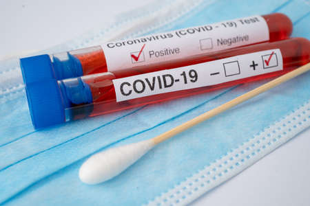 COVID-19 virus or Coronavirus sample blood test tube in laboratory of hospital.の写真素材