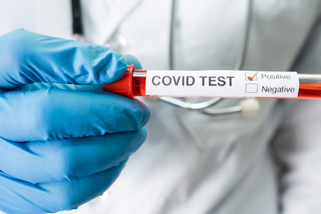 Positive blood infection sample in test tube for covid-19 coronavirus in lab. Scientist holding to...