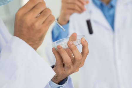 Close-up of laboratory workers doing a blood testの写真素材