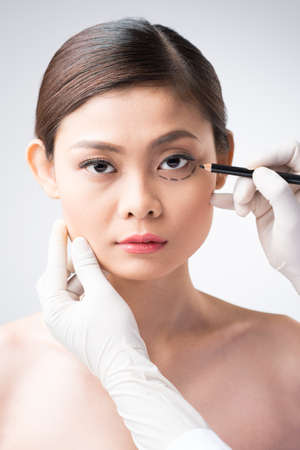 Cosmetic surgeon drawing correcting lines under women?s eyesの写真素材