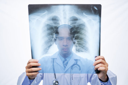 Doctor examining lungs x-ray in his hands