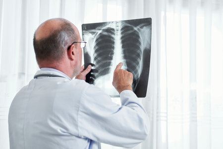 Radiologist examining lungs x-ray of patient and searching for signs of cancerの写真素材