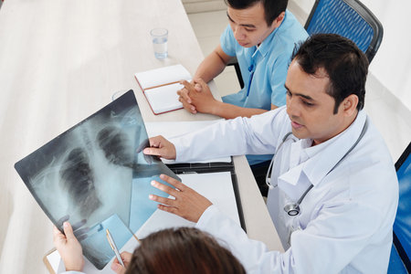 Pulmonologist discussing lungs x-ray of patient with his team and searching for signs of coronovirus...