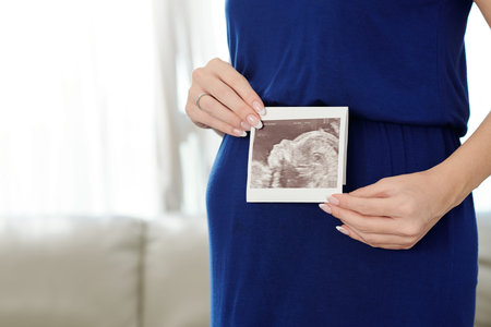 Close-up image of future mother showing ultrasound picture of growing babyの写真素材