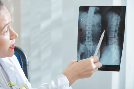 Female surgeon pointing at spine x-ray of patient when trying to figure out diagnosis
