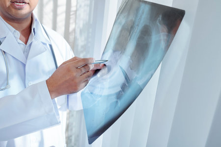 Cropped image of doctor examining lungs x-ray of patient and trying to figure out diagnosis