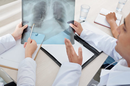 Lungs x-ray of patient with pneumonia in hands of general practitioners discussing symptoms