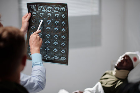 Close-up of doctor pointing at x-ray image of patient and examining it, and explaining the problem to visitor while they standing in wardの写真素材