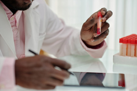 Hand of young African American clinician holding flask with blood sample while studying characteristics of new virus in laboratoryの写真素材