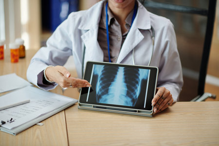General practitioner showing tablet computer with x-ray image of lunges on screen