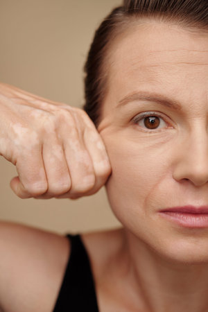 Face of mature woman pulling back skin of her face to get rid of wrinkles