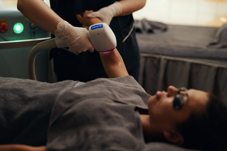 Beautician removing hair from arms of clientの写真素材