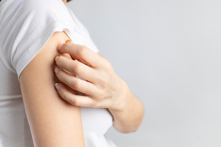 Young woman scratching her itchy arm. Skin problems conceptsの写真素材