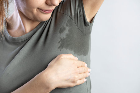 Young woman with hyperhidrosis sweating. Young woman with sweat stain on her clothes. Excessive...