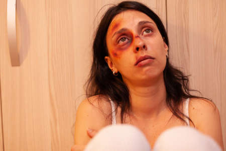 Abused woman with bruises crying after being brutaly beating by husband. Traumatised helpless...