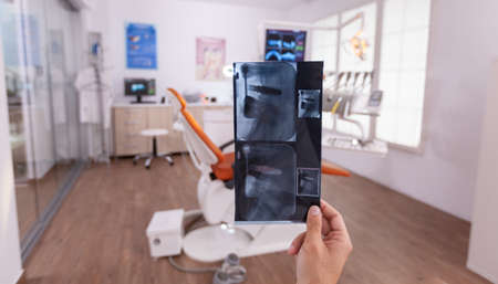 Orthodontist man doctor holding teeth medical radiography planning healthcare teethcare treatment...