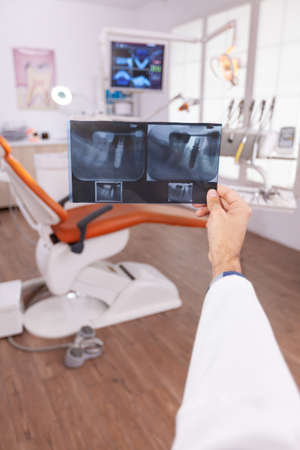 Specialist radiologist holding medical teeth radiography in hands examining teethcare surgery expertise. Orthodontist doctor working in stomatology dental orthodontic hospital office roomの写真素材
